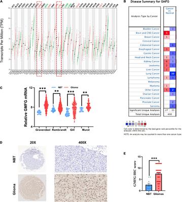 Expression and Prognostic Role of Glia Maturation Factor-γ in Gliomas